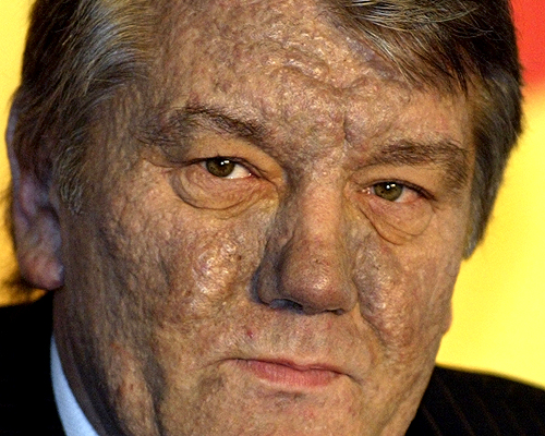 Viktor Yushchenko